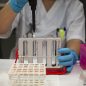 Rapid Test disebut lebih Baik Ketimbang Tes PCR, Kok Bisa